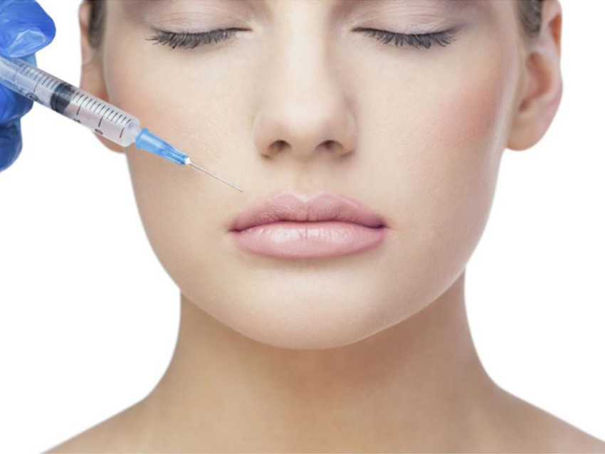 Evolution Derma Fillers